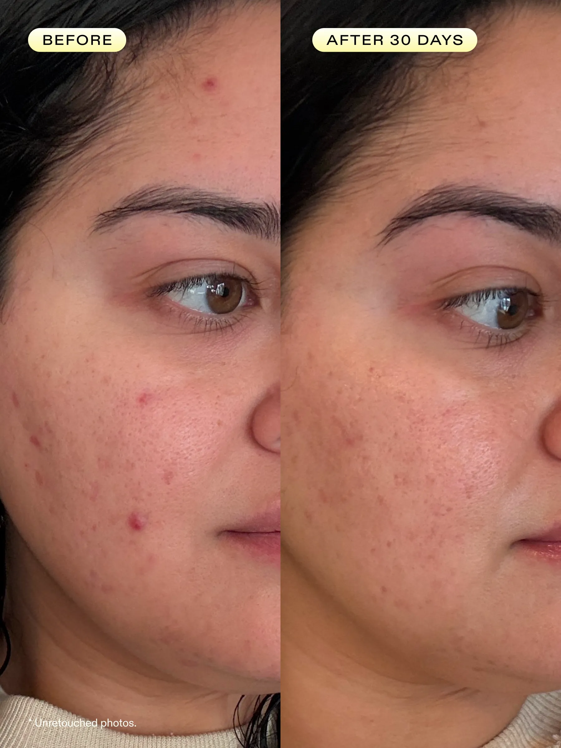 Before & After 30 Days