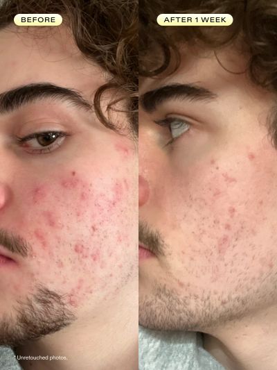 Product from Krave Beauty