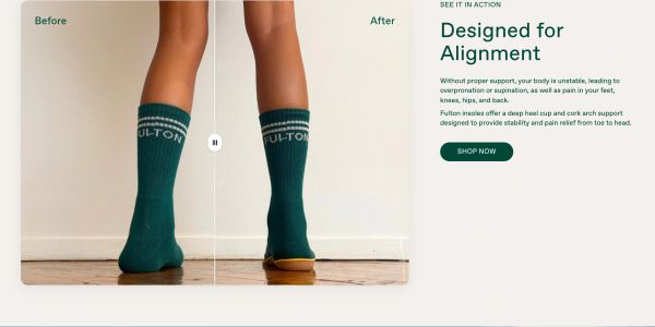 Alignment Before & After